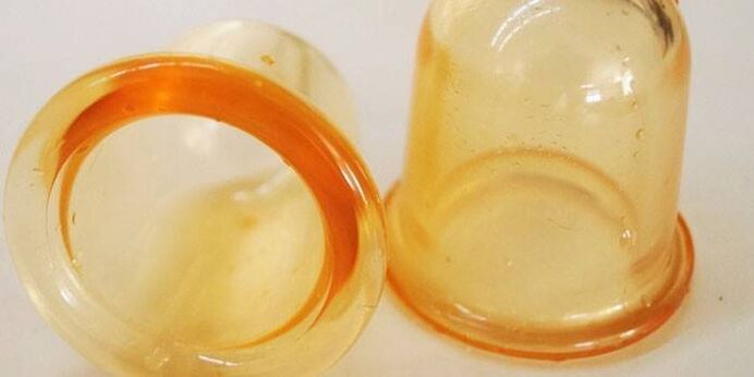 простатитті емдеуге арналған шыныаяқтар